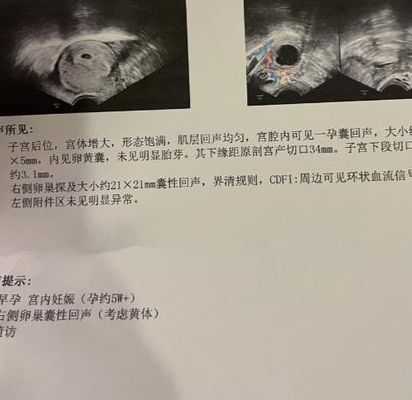 着床出血是不是代表怀孕成功了？大多数怀上的人根本没出血