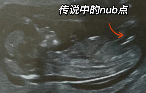 nt看男女nub