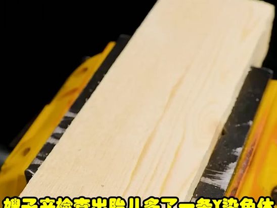 47染色体多一条，我签字放弃时手在抖
