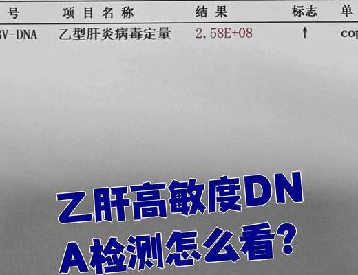 CMV DNA是什么检查？抓病毒现行还是查免疫记忆？