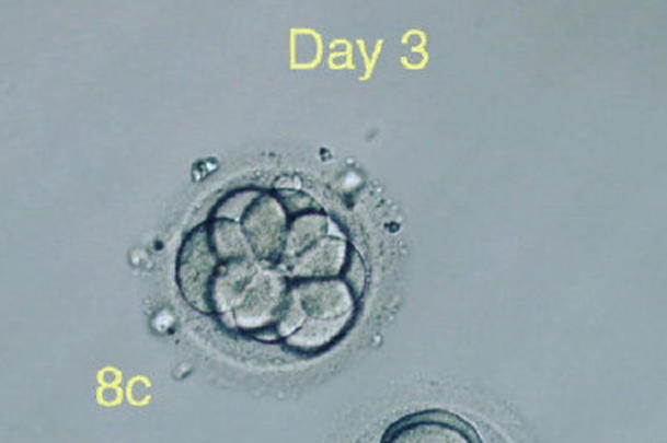 3天胚胎8细胞被视为理想状态