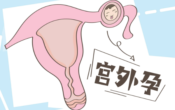 试管移植异位妊娠的比例高不高看子宫内膜?