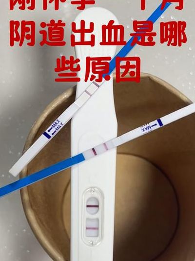 孕早期出血像来大姨妈一样，4个判断维度快速分辨该不该冲急诊