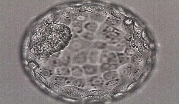 5细胞胚胎医生不建议移植