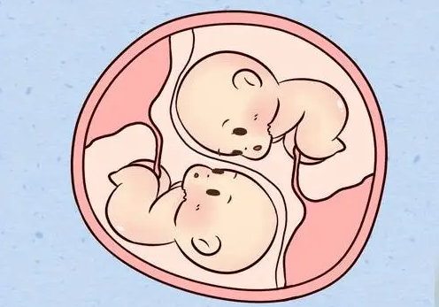 试管怀双胞胎的对女性身体条件