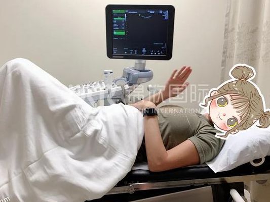 格鲁吉亚试管助孕医院，34岁小周第三次移植终于等来胎心