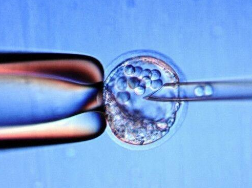 都说高龄试管一定要做三代，预测胚胎健康才是目的！