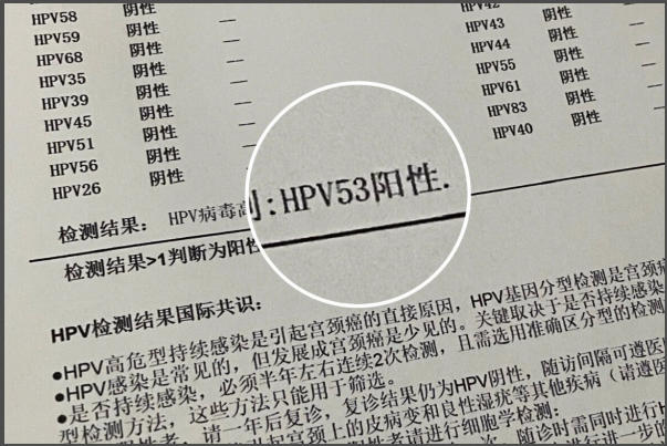 优生五项检查阳性并不代表胎儿有问题