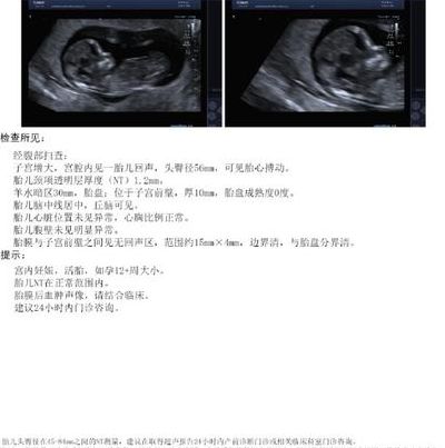 32岁林敏第二次胎停，攥着报告单没哭，翻了翻手机，不知该打给谁