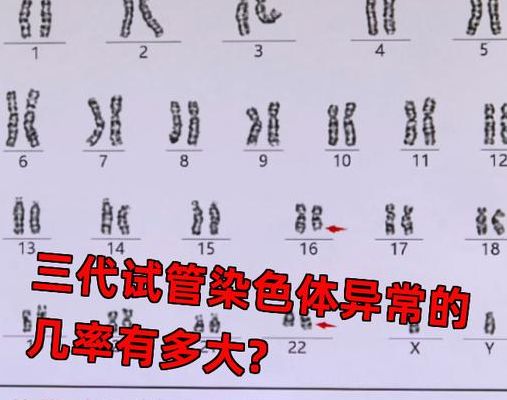 女性染色体异常可以怀孕吗？三步判断你的生育可能