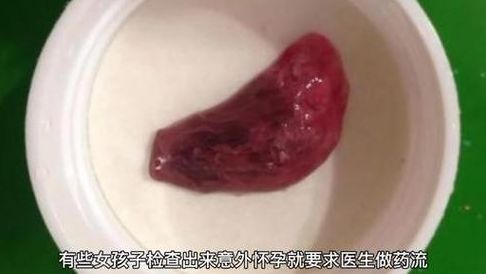 移植第二天囊胚流出来了图片是真是假？你别自己吓自己
