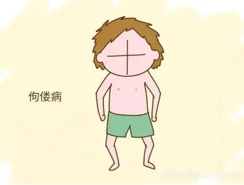 佝偻病后脑勺扁平
