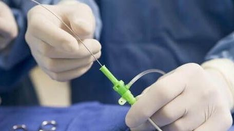 四川华西第二医院做试管婴儿从进周到移植到底要花多少钱？