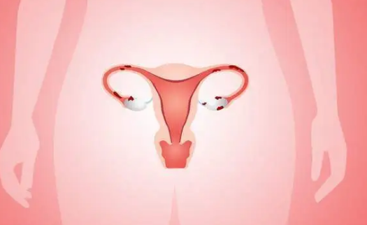 子宫内膜息肉是常见的妇科疾病