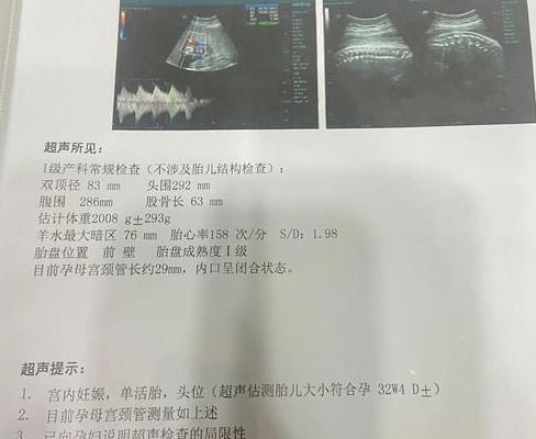 太准了胎心看男女150正常吗？我拿着产检单追着医生问了一遍