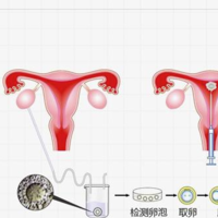 50岁做供卵试管成功率没月经怎么做供卵
