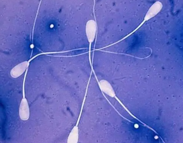 精子畸形做二代能生育