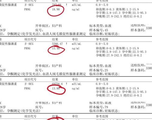 hcg翻倍慢一定是胚胎发育不好吗？先别慌，分三步判断怎么办