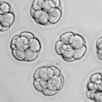 试管移植三级胚胎和自然受孕比哪种生育风险更高？