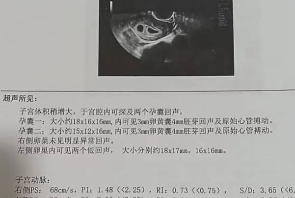 图片上显示胎儿头部偏大形似小海马