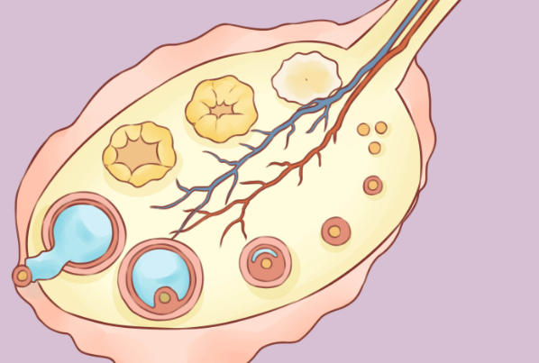 多囊卵巢可以试管怀双胎