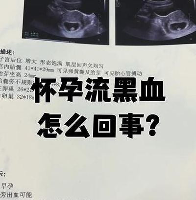 怀孕梦见自己下面流血是怎么回事？要不要紧