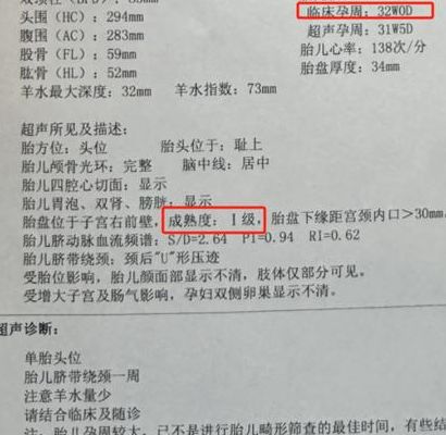 孕32周到34周是危险期,这14天到底危险在哪