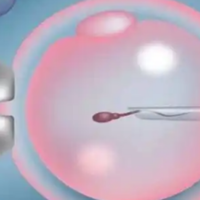 有人能说下赴美生子办理b类签证流程怎么样的吗?