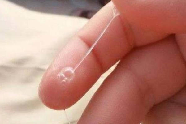 请问排卵期分泌的白带是什么样的，有图片吗？