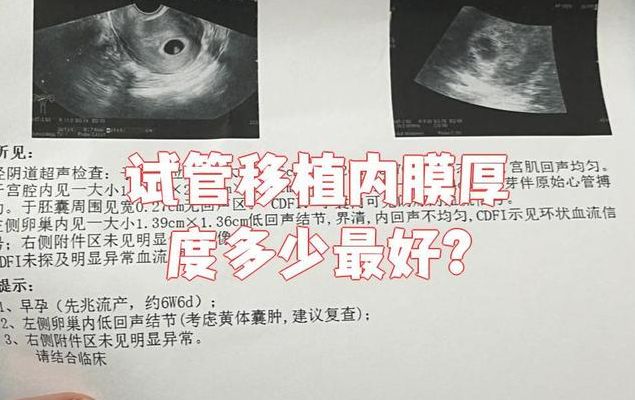 内膜太厚可以做试管吗_关键看这3种情况再决定