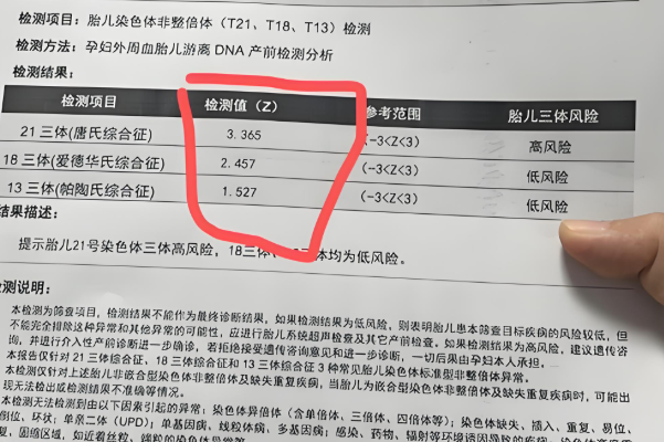 无创dna数值低代表低风险
