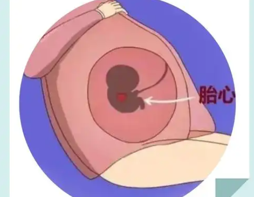 胎心率在一定范围内是正常的