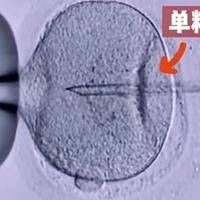 二代试管可以选择男女吗？医学真相与法律边界一次说清