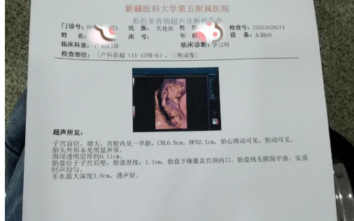 NT检查可判断胎儿发育问题
