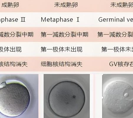 卵母细胞采集疼不疼？4个判断维度决定你的实际感受