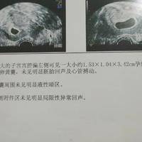 南宁做试管优质的医院排名：别被&ldquo;优质&rdquo;两个字带偏