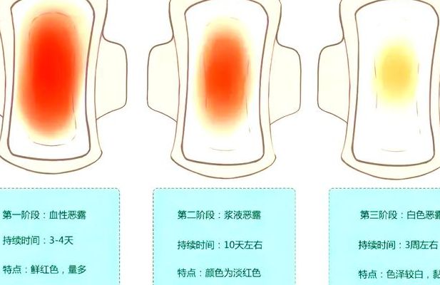 产后怎么判断是月经还是出血？看恶露结束时间和出血颜色就能分清