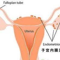 山东替人代生孩山东供卵中心,山东供卵医院