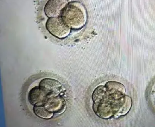 三级胚胎不决定胎儿性别