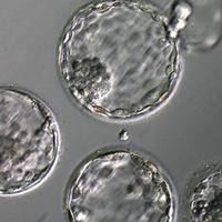 试管养囊和不养囊的区别?适用人群与风险的差异