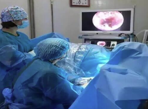 患者正在做宫腔镜检查