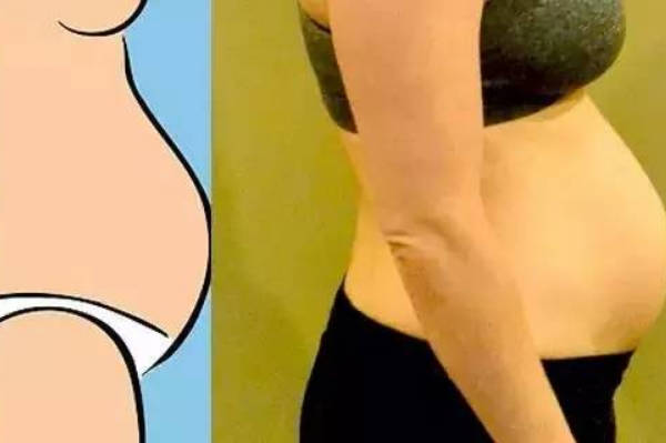 请问女性小腹胖与怀孕的区别是什么，有图片可参考吗？