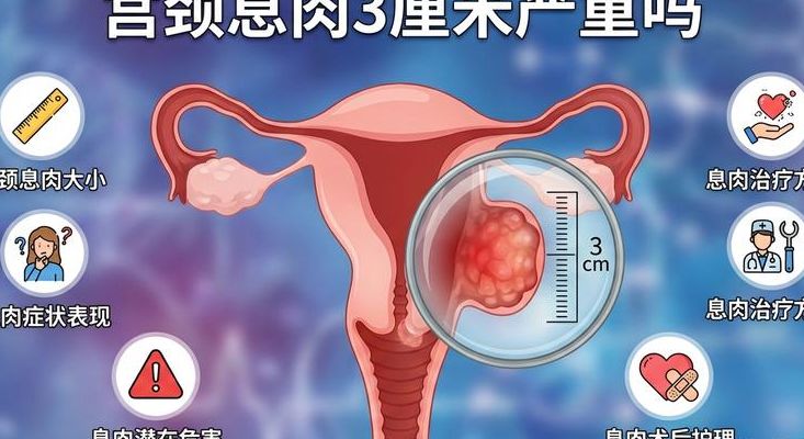 宫颈息肉影响怀孕吗？关键不看有没有息肉，看这3点