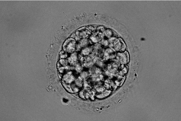 碎片率高导致胚胎发育异常