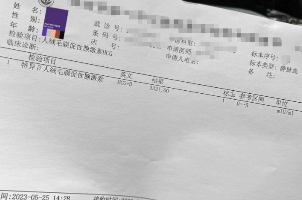 HCG值无法判断胎儿性别