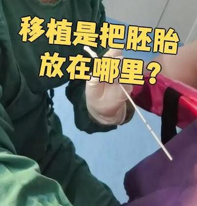 试管怀孕时间从什么时候开始算？34岁小周从验孕棒吵到B超室