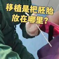 试管怀孕时间从什么时候开始算？34岁小周从验孕棒吵到B超室
