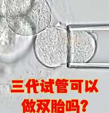 做试管可以选择做双生子吗？生殖中心咨询师说透真实答案