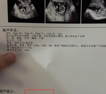 美国试管要多少钱一个？费用价格攻略与8笔开销明细