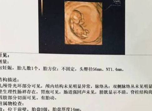 医生说胎儿偏大暗示男孩，我试管一路走来的真实记录